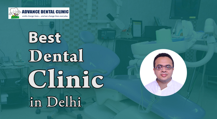 Best Dental Clinic in Delhi
