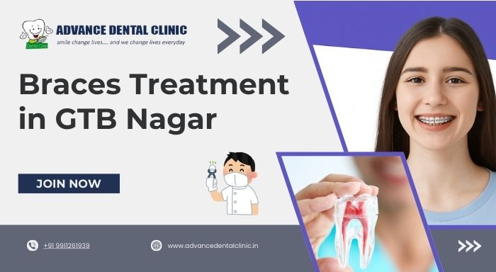 Braces Treatment in GTB Nagar
