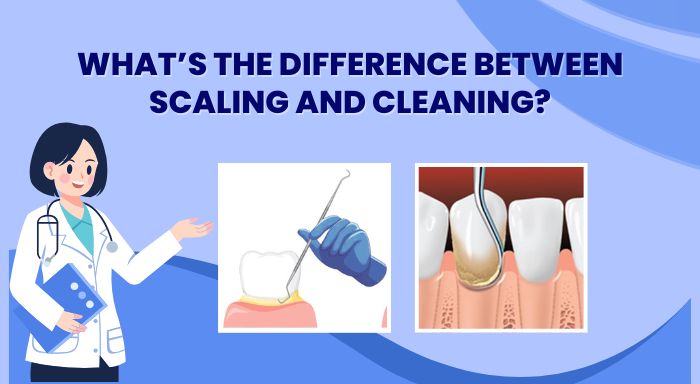 Difference between Scaling and Cleaning