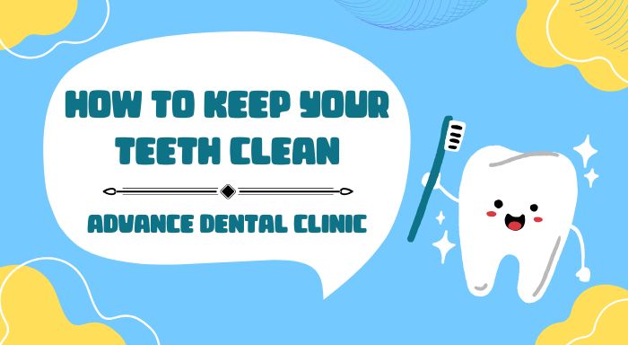 How to Keep Your Teeth Clean
