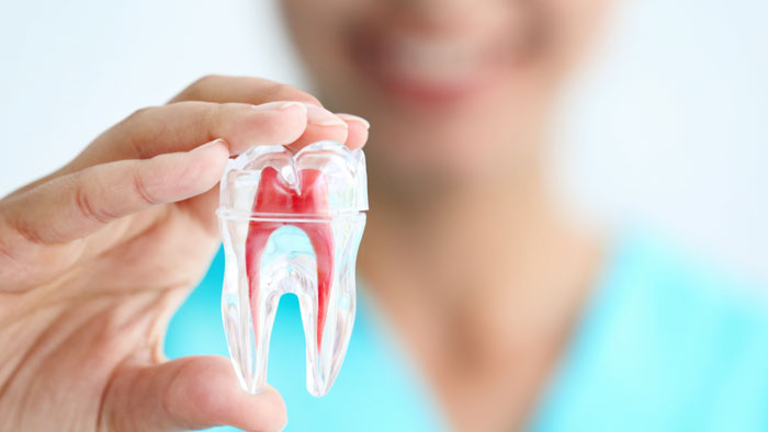 Root Canal in Vijay Nagar